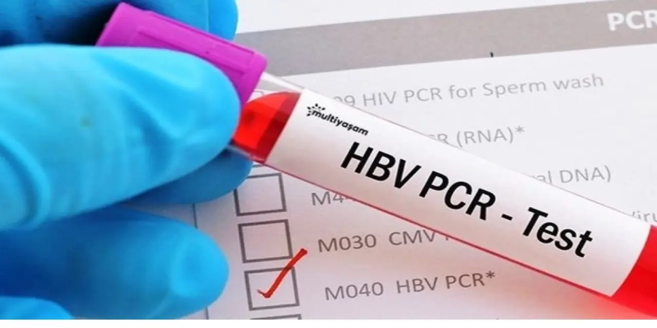 PCR testi ücreti belli oldu! PCR test ücreti ne kadar?