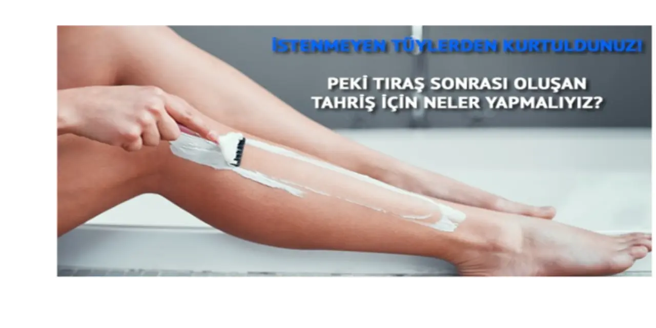 Tüylerinizden Arındınız. Peki Tıraşın Ardından Oluşan Tahriş İçin Neler Yapmalısınız?